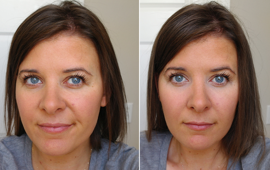 before-after-concealer